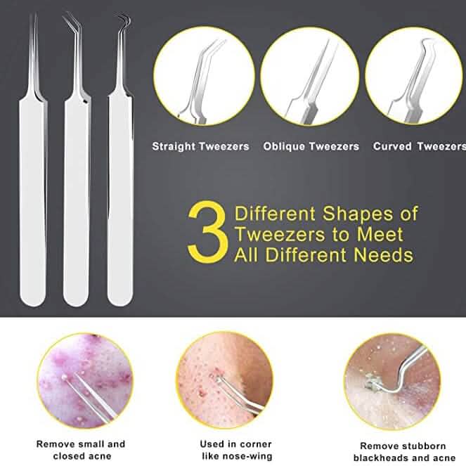 10-Piece: Blackhead Remover Tool