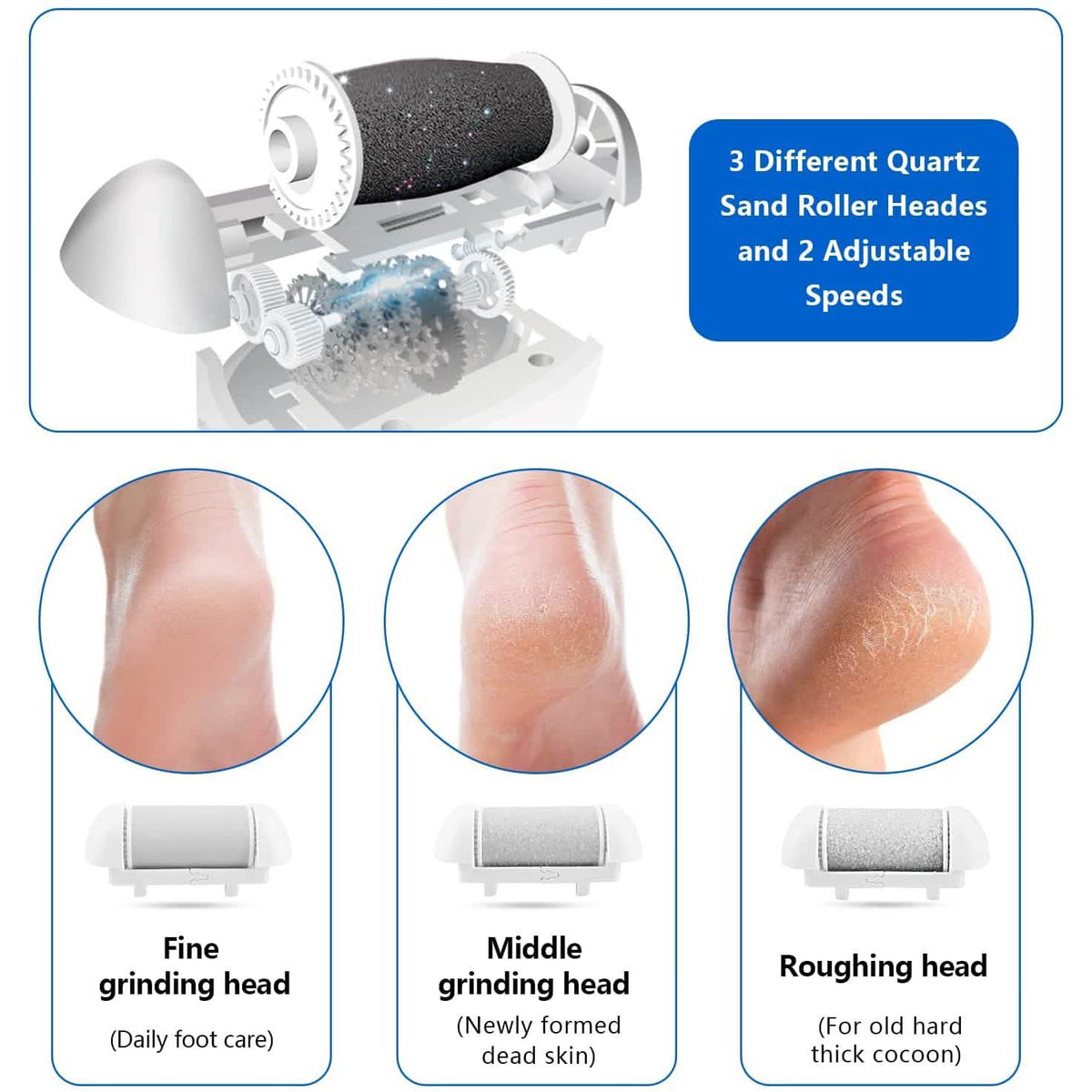 Elmchee Rechargeable Foot Callus Remover Kit
